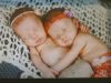Twins, Born, birth, miracle, babies, Parents, amazing, story,