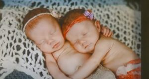 Twins, Born, birth, miracle, babies, Parents, amazing, story,