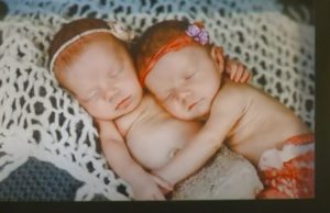 Twins, Born, birth, miracle, babies, Parents, amazing, story,