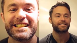 Homemade, Teeth, Natural remedy, Teeth whitening, trick, tips, Health,