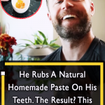 Genius Homemade Paste for Teeth whitening