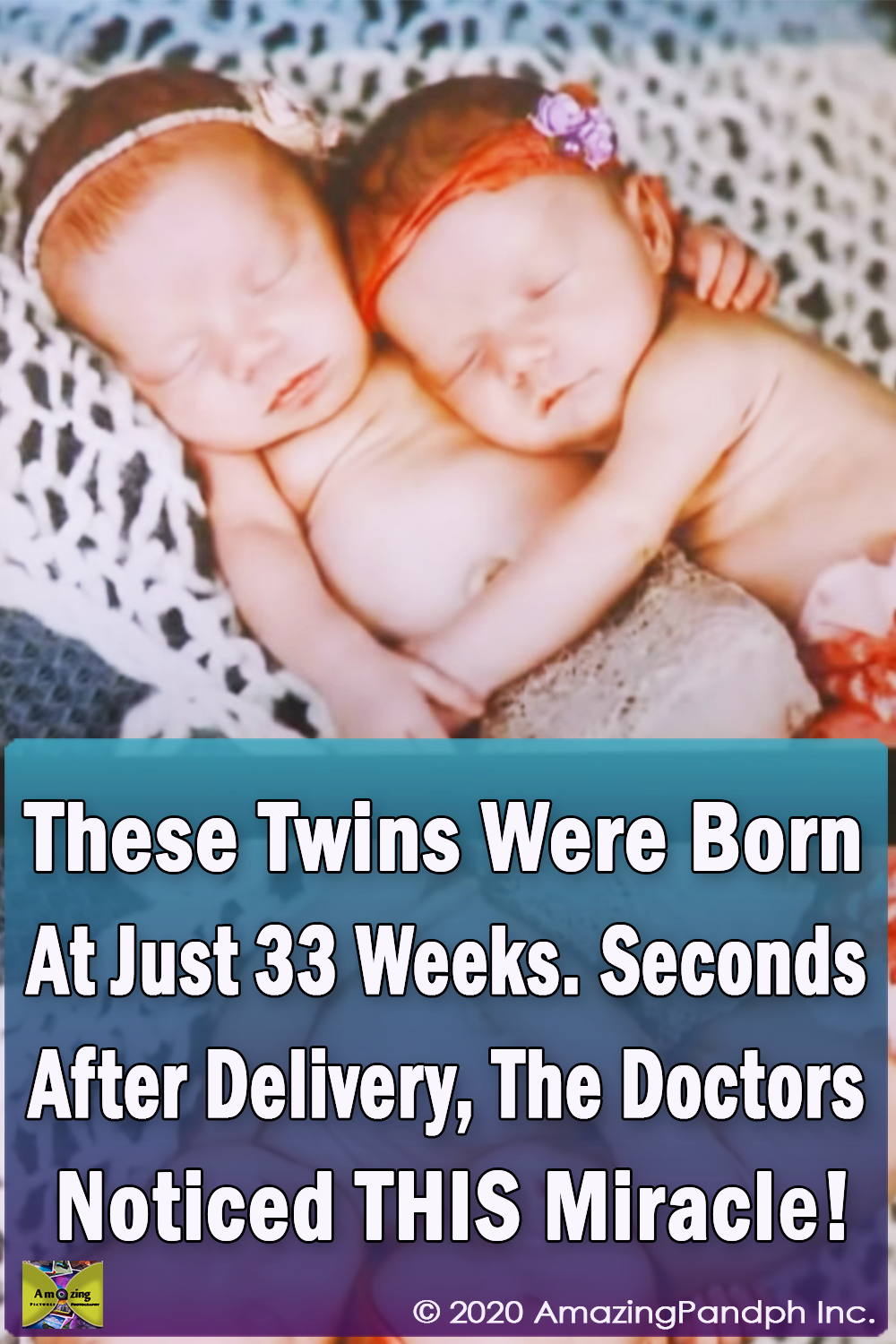 Twins, Born, birth, miracle, babies, Parents, amazing, story,