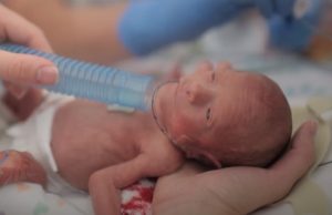 babies, mothers, love, motivation, Story, Survive, doctors, nurses,
