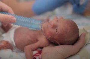 babies, mothers, love, motivation, Story, Survive, doctors, nurses,