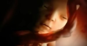 Fetal development video, Nine months in the womb, Prenatal care, Miracle of life, Fetal imaging ethics, Protecting life, Conception, Fetus, Health and well-being, Maternal health, Baby development, Parenting, Obstetrics, Neonatology, Childbirth, Pregnancy