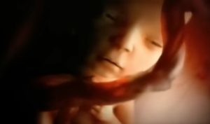Fetal development video, Nine months in the womb, Prenatal care, Miracle of life, Fetal imaging ethics, Protecting life, Conception, Fetus, Health and well-being, Maternal health, Baby development, Parenting, Obstetrics, Neonatology, Childbirth, Pregnancy