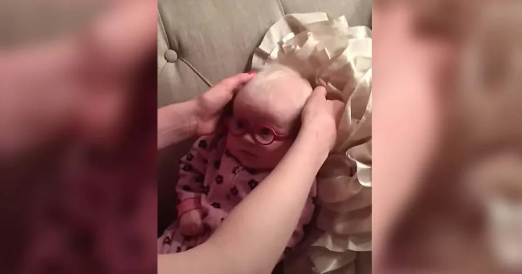 Baby sees mom for the first time, New glasses, Heartwarming moment, Vision correction, Baby’s first clear vision, Baby’s reaction to glasses, Seeing mom clearly, Viral baby glasses video, Emotional first sight, Baby with vision problems