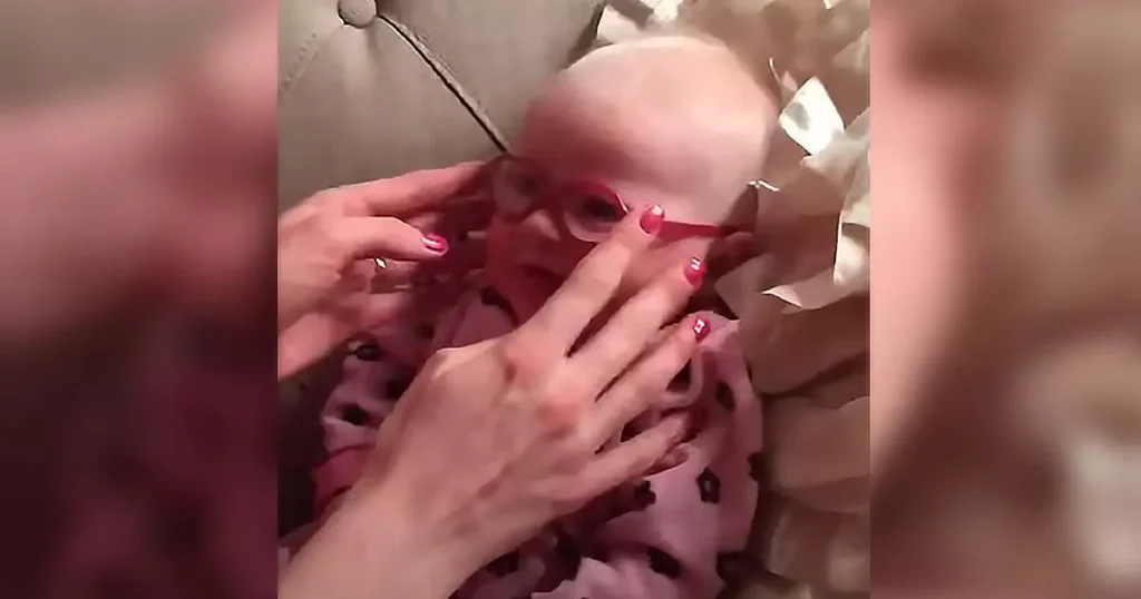 Baby sees mom for the first time, New glasses, Heartwarming moment, Vision correction, Baby’s first clear vision, Baby’s reaction to glasses, Seeing mom clearly, Viral baby glasses video, Emotional first sight, Baby with vision problems