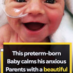 A Premature Baby with a Beautiful Smile