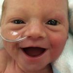 A Premature Baby with a Beautiful Smile