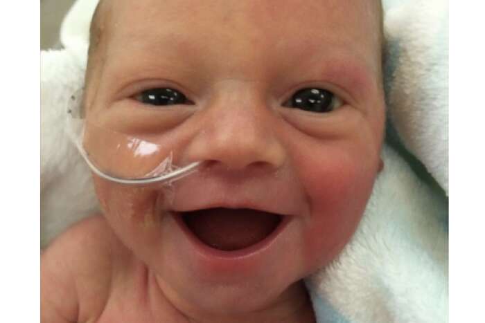 premature, baby, parents, smile, hope, life, birth, grin, beautiful smile,