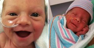 premature, baby, parents, smile, hope, life, birth, grin, beautiful smile,